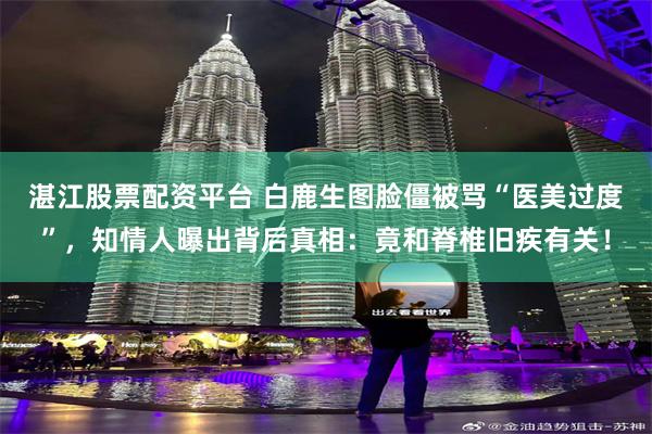 湛江股票配资平台 白鹿生图脸僵被骂“医美过度”，知情人曝出背后真相：竟和脊椎旧疾有关！